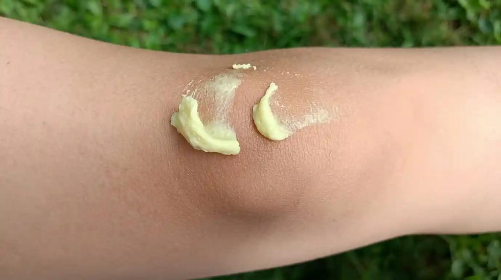 Kittlova mast -aplikace na koleno